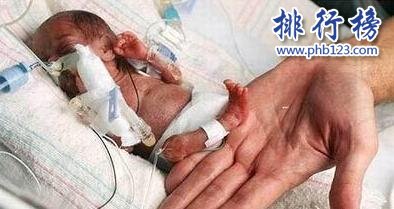 世界上最小的婴儿：体重仅200多克，小袋洗衣粉都比他重